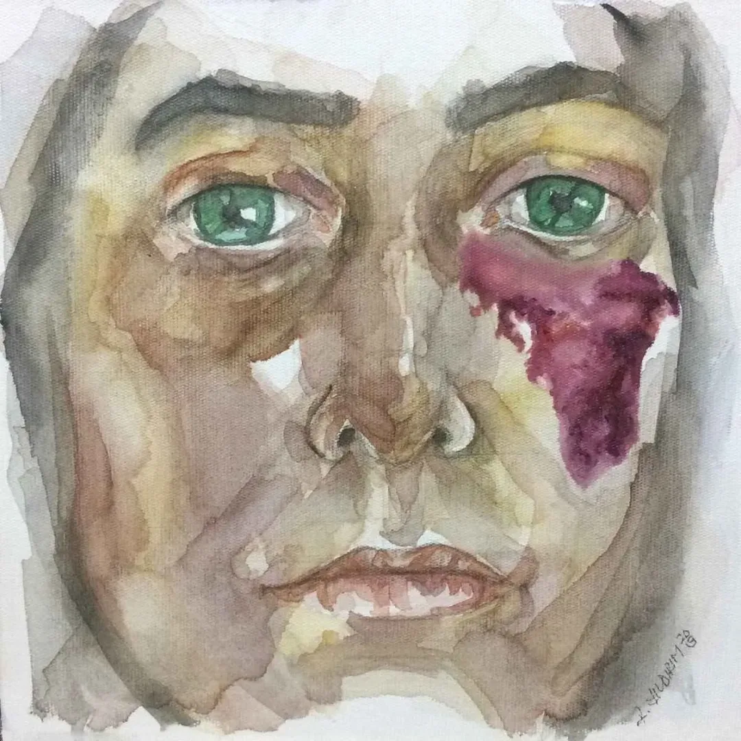 RABİA YILDIRIM — “İsimsiz”, 2019 "İsimsiz" eseri RABİA YILDIRIM tarafından 2019 yılında 25x25 cm ölçülerinde Tuval üzeri akrilik boya tekniği ile yapılmıştır.